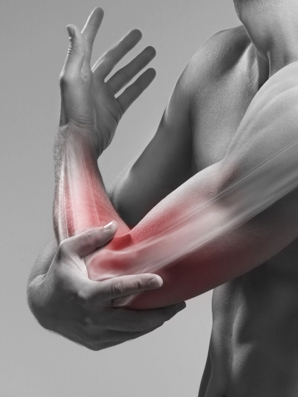 fisioterapia
