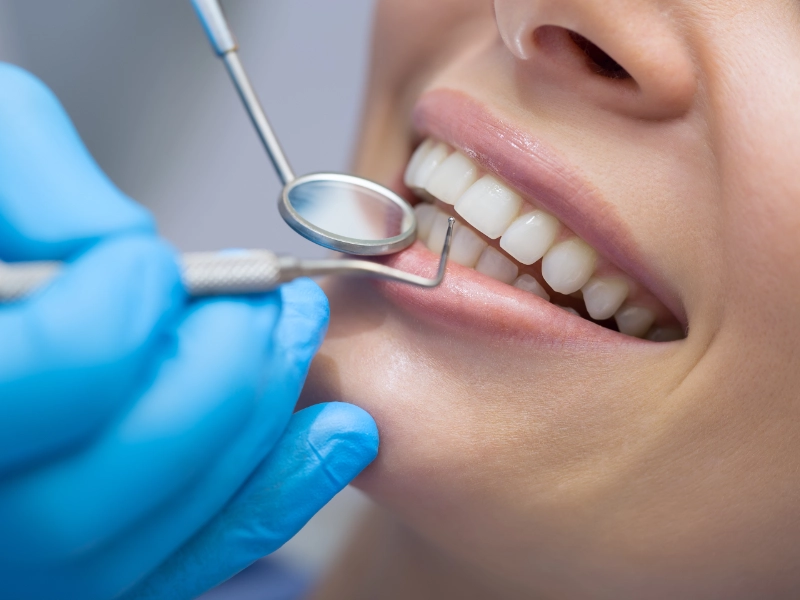 pulizia-dei-denti-per-il-tuo-sorriso